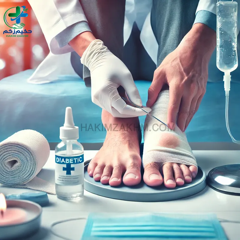 درمان زخم های دیابتی