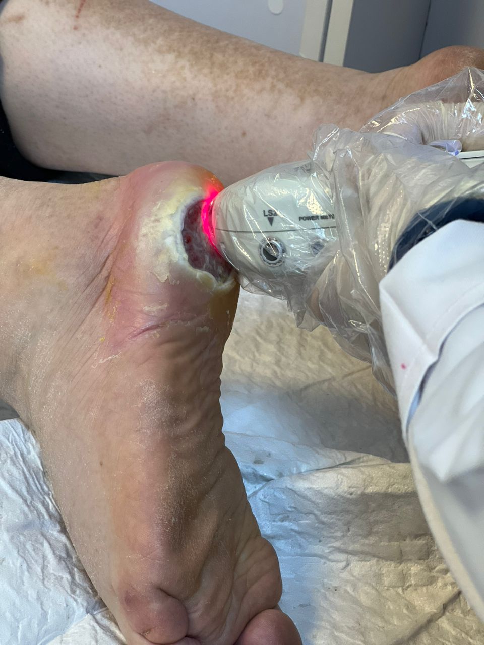 مریم برخورداری حکیم زخم